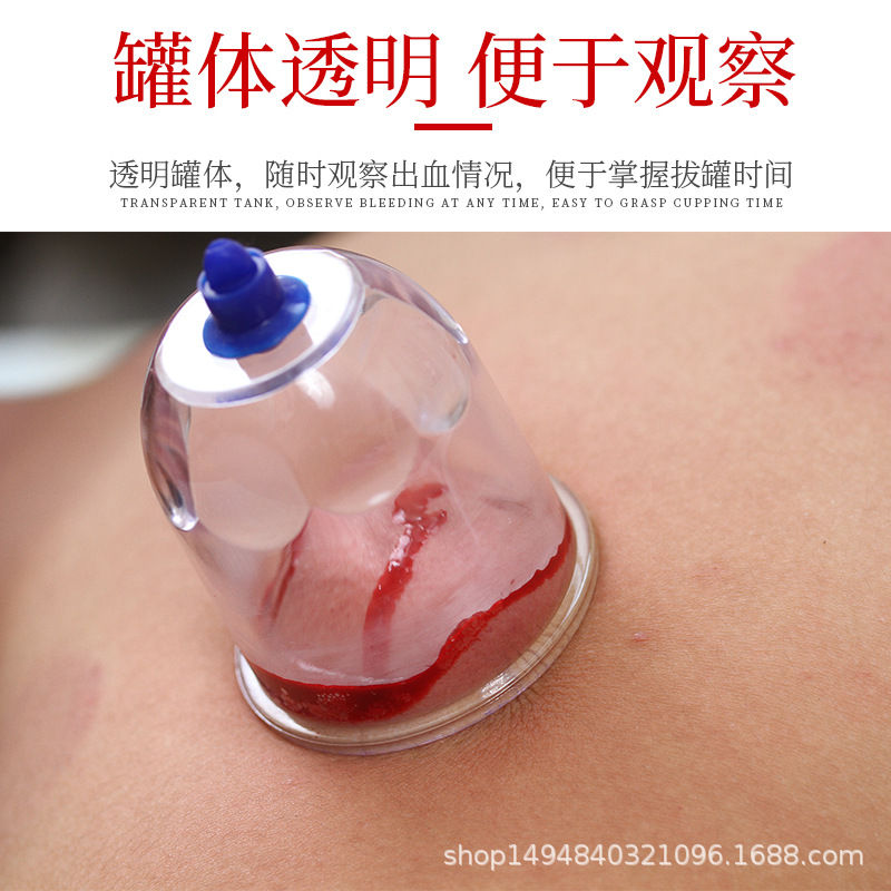 Negative Pressure Cupping Vacuum Cupping Device Household Air-Extracting Air Tank Heart-Warming Bruises and Blood-Pulling Tank Diarrhea Blood-Removing Blood Stasis Set