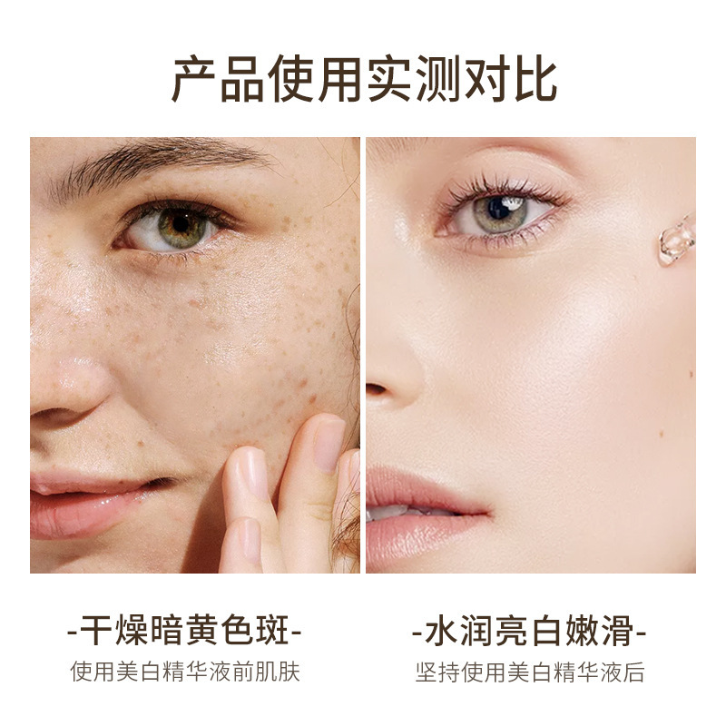 Skin-grind Whitening and Freckle Removing Essence Niacinamide Freckle Removing Moisturizing and Hydrating Smoothening Skin Brightening Essence
