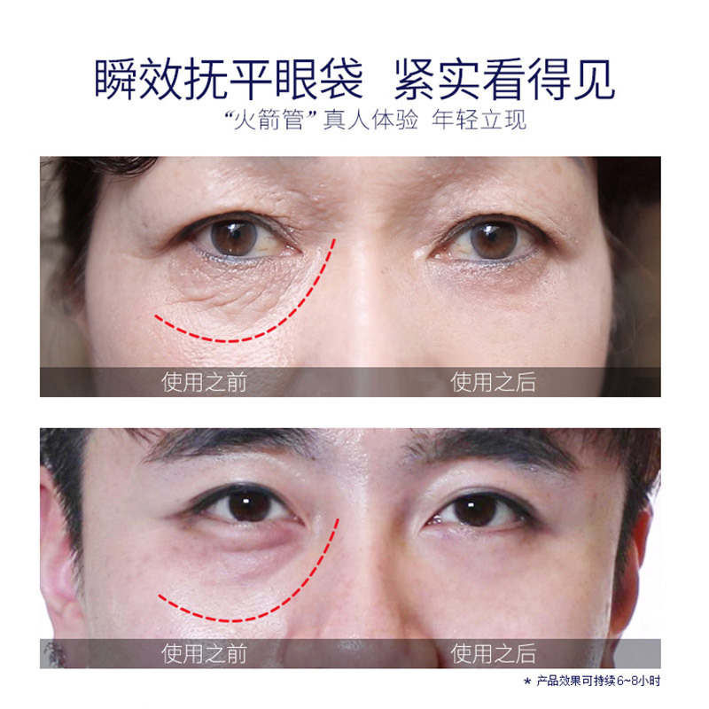 120 seconds fast eye bag cream wholesale snake venom eye cream eye bags black rim of the eye to genuine counter wrinkle firming