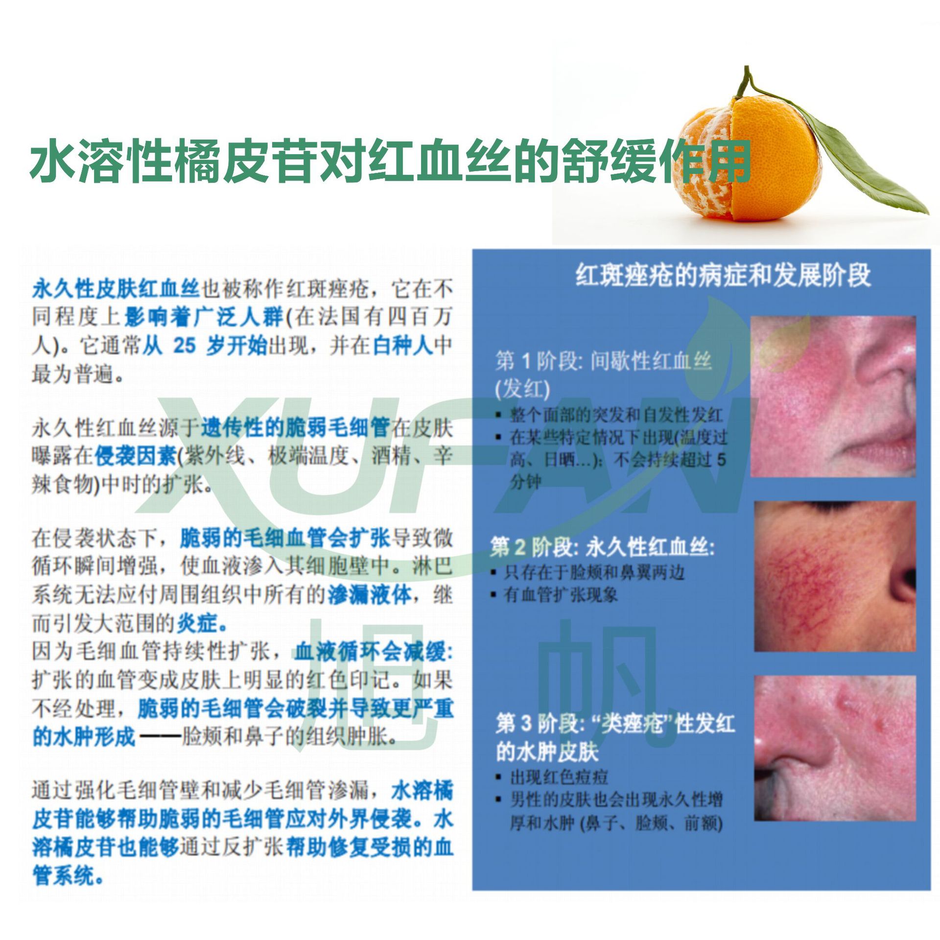 99% Content Water-Soluble Naringin Promotes Microcirculation, Starting from 10 Grams, Packaged