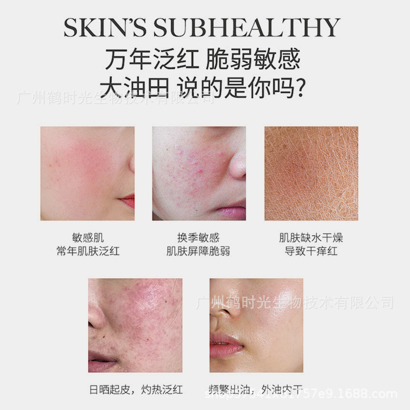 Beauty Salon Ice Crystal Gel Mask, Hydrating Postoperative Cold Compress, Soothing, Calming, Redness Reducing, Antipyretic, Repairing, Rejuvenating and Moisturizing