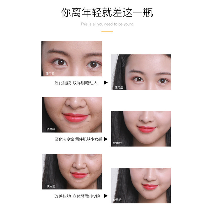 Anti-Wrinkle Essence Firming, Lifting and Diluting Fine Lines, Removing Nasolabial Folds, Forehead Wrinkles, High-Concentration Bud Spore Essence