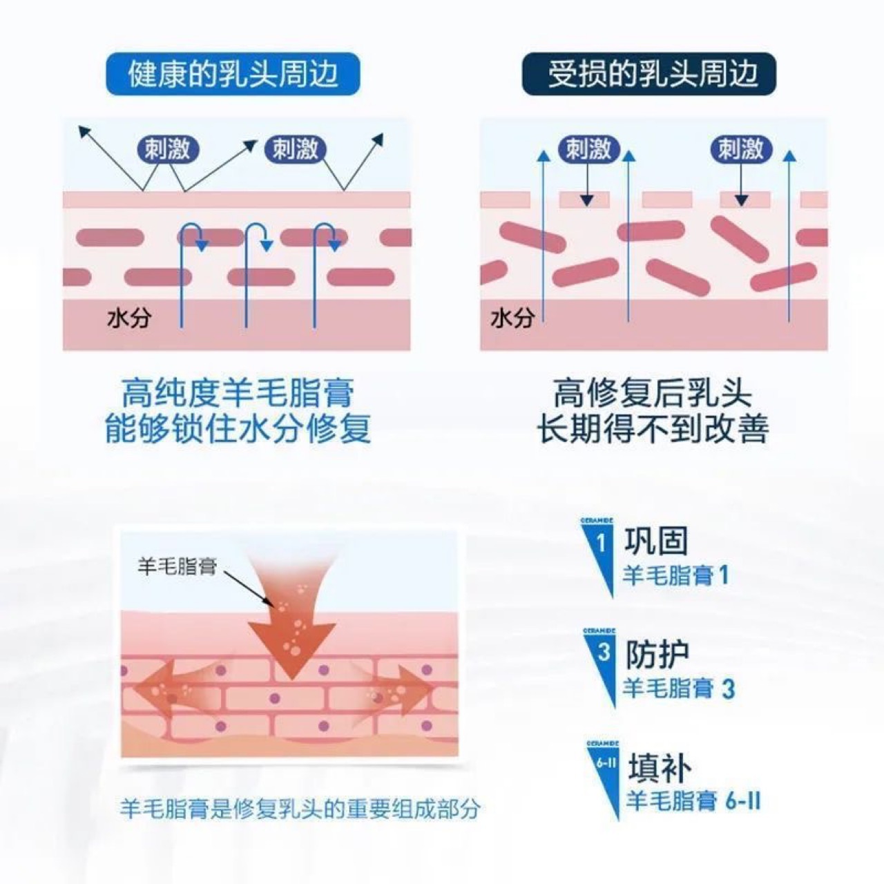 Wool Fat Cream, Nipple Chapped Cream, Nursing Cream, Nipple Pain, Breastfeeding Pain, Pregnant Women's Skin Care, Chapped Repair, Mutton Fat