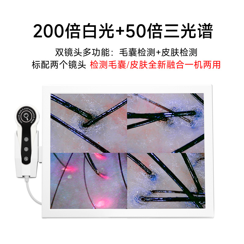 15-inch four-compartment scalp detector HD all-in-one machine intelligent hair follicle hair analyzer skin detector
