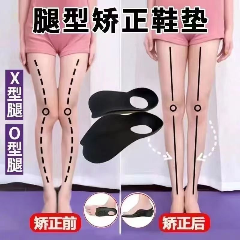 ортопедическая стелька для коррекции плоскостопия xo типа, легкая плантарная ортез, стелька для стопы с варусной деформацией