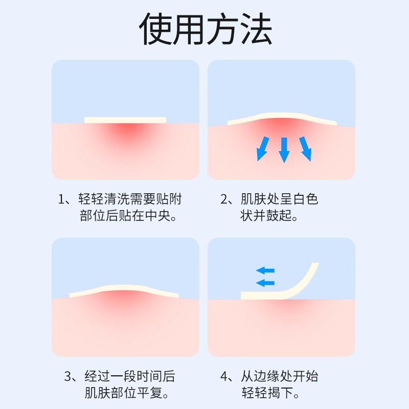 Medical Acne Patch Waterproof Hydrocolloid Non-Cicatrizant Acne Scar Acne Mark Artificial Skin Band-Aid Invisible Dressing
