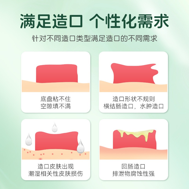 Toeneng plastic patch ring stoma care supplies ostomy bag ostomy chassis leak-proof patch leak-proof ring sealing elastic glue