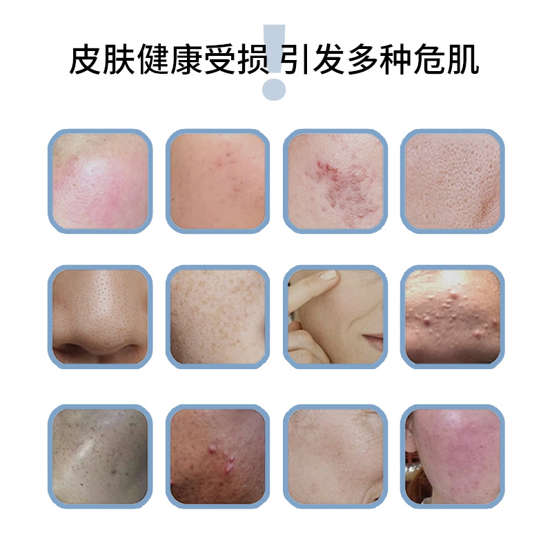 Medical Dressing for Postoperative Recovery in Medical Beauty Salons, Medical Recombinant Type Ii Hyaluronic Acid Hormone-Free Combination