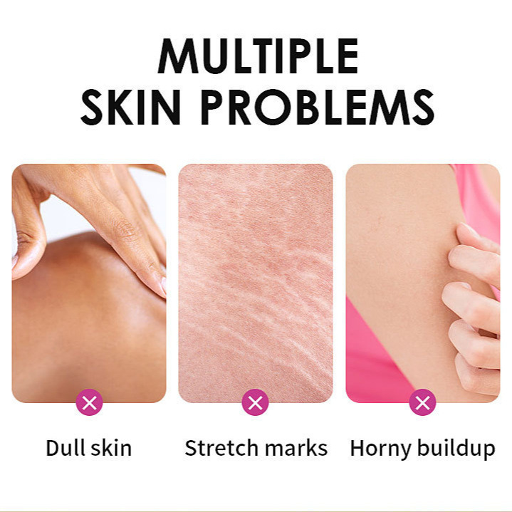 Cross Border Exclusive Yellow Peeling Oil Elbow Knee Finger Yellow Exfoliating Oil Peeling Oil