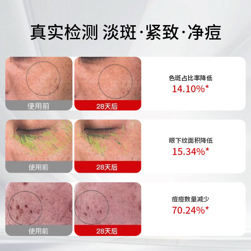 New Home LED Photonic Skin Rejuvenation Beauty Mask 7 Color LED Light Breathable Hollow Mask Mask Instrument