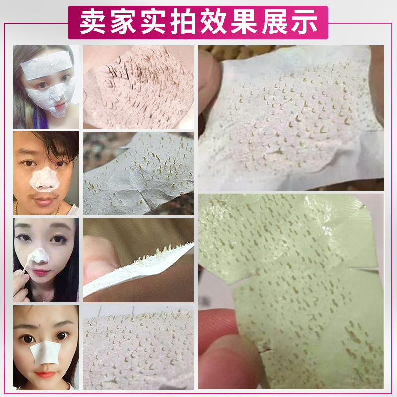 General trade Thailand blackhead removing water nose patch Garysoon white aloe vera gel unisex pig nose patch