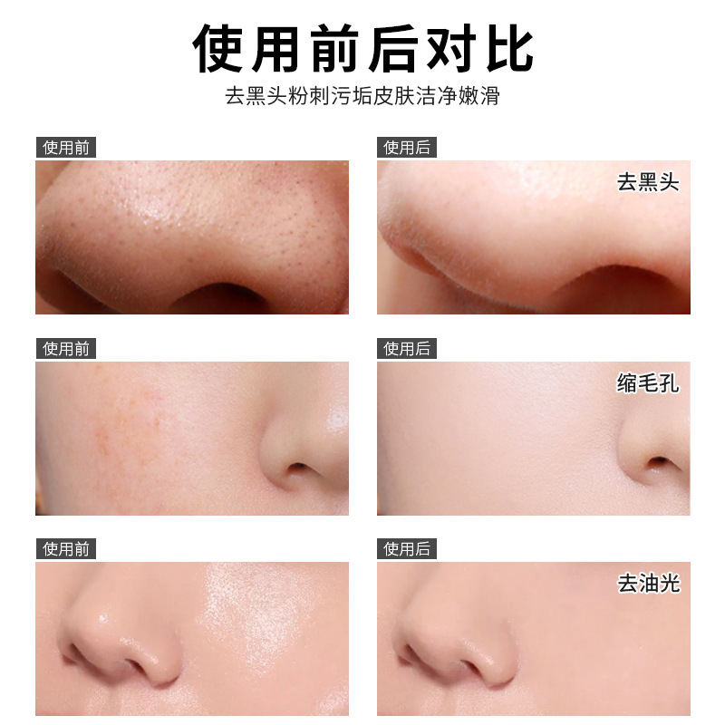 Jinniya suction blackhead nose mask shrink pores blackhead removing men and women cleansing acne tearing mask wholesale