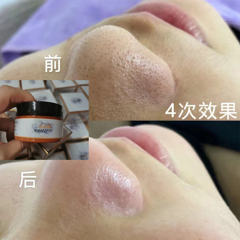 Крем для очищения пор для салонов красоты удаляет черные точки и акне