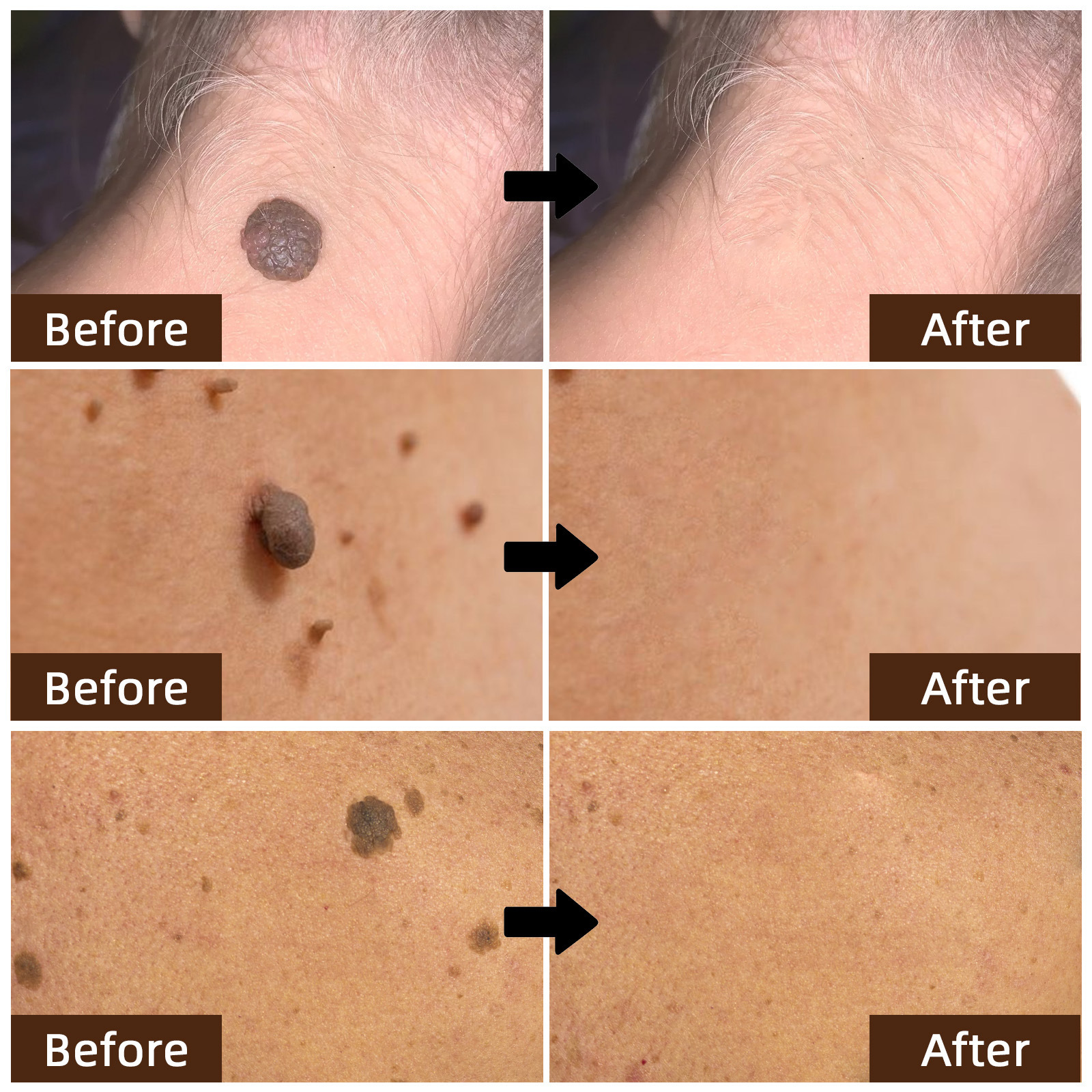 Cross-Border Bee Venom Skin Care Cream Body Skin Cleansing Keyou Smoothing Skin Bee Venom Care Cream