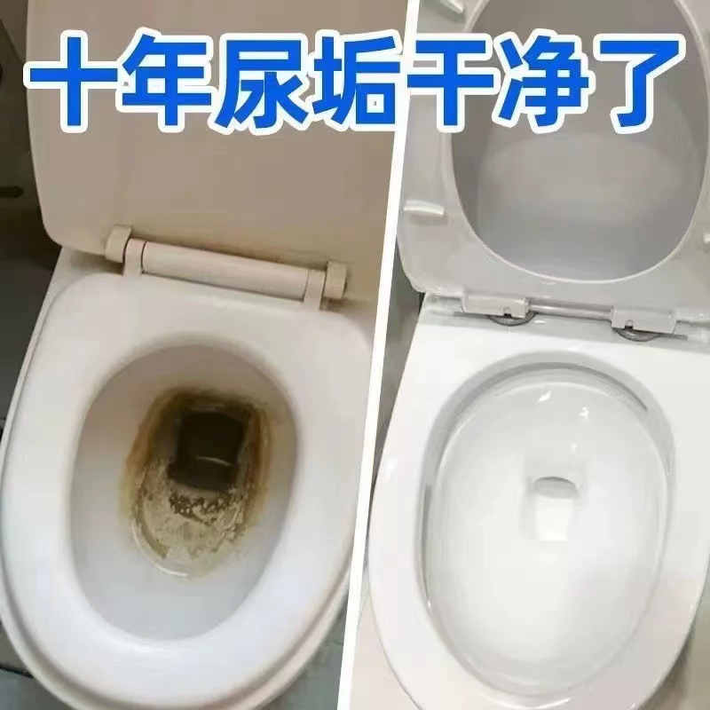 Toilet Descaler, Stain Remover, Urine Scale Dissolver, Toilet Cleaning Supplies, Urine Scale Remover, Stain and Odor Cleaning Agent