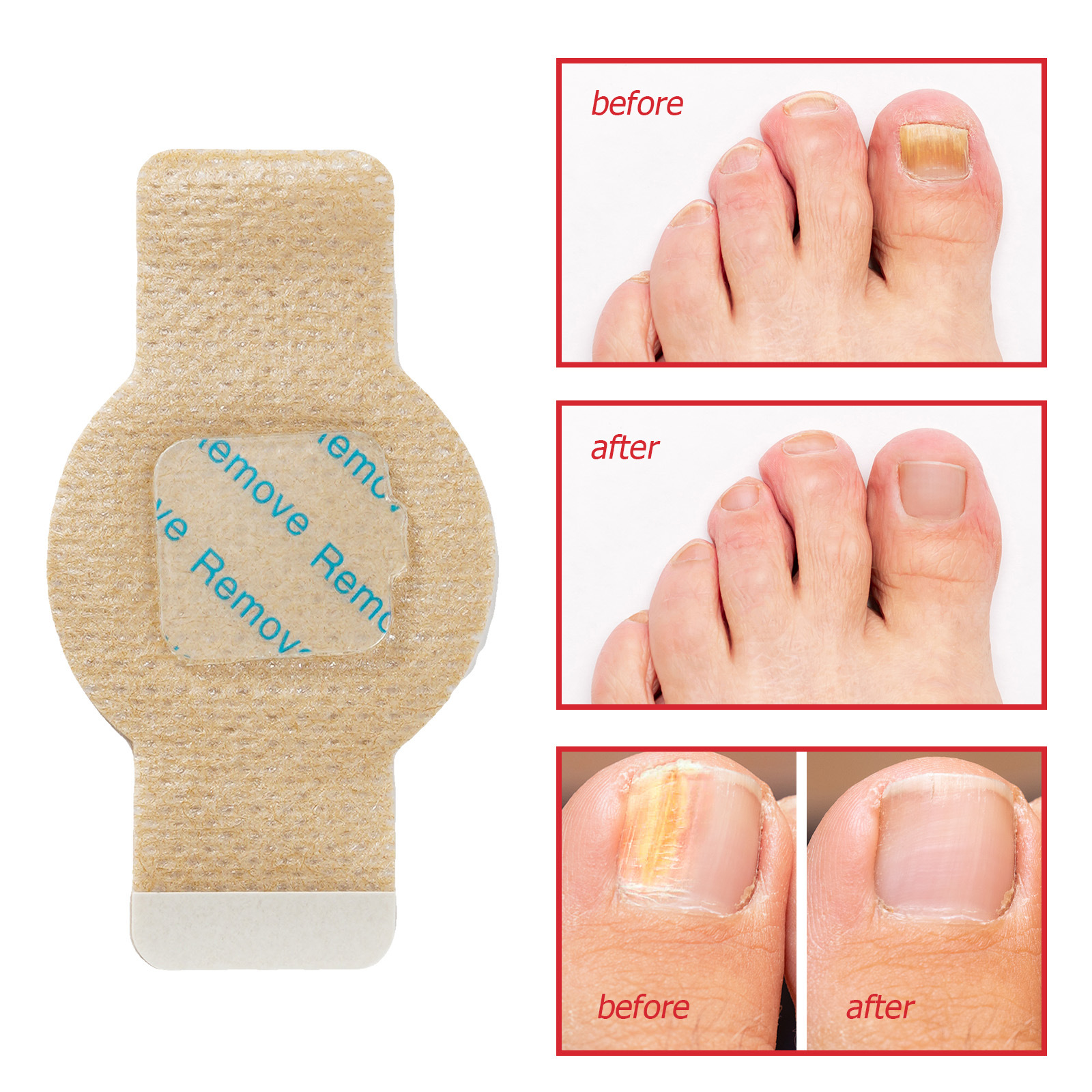 Elaimei Foot Nail Patch Fungal Nail Patches 21P