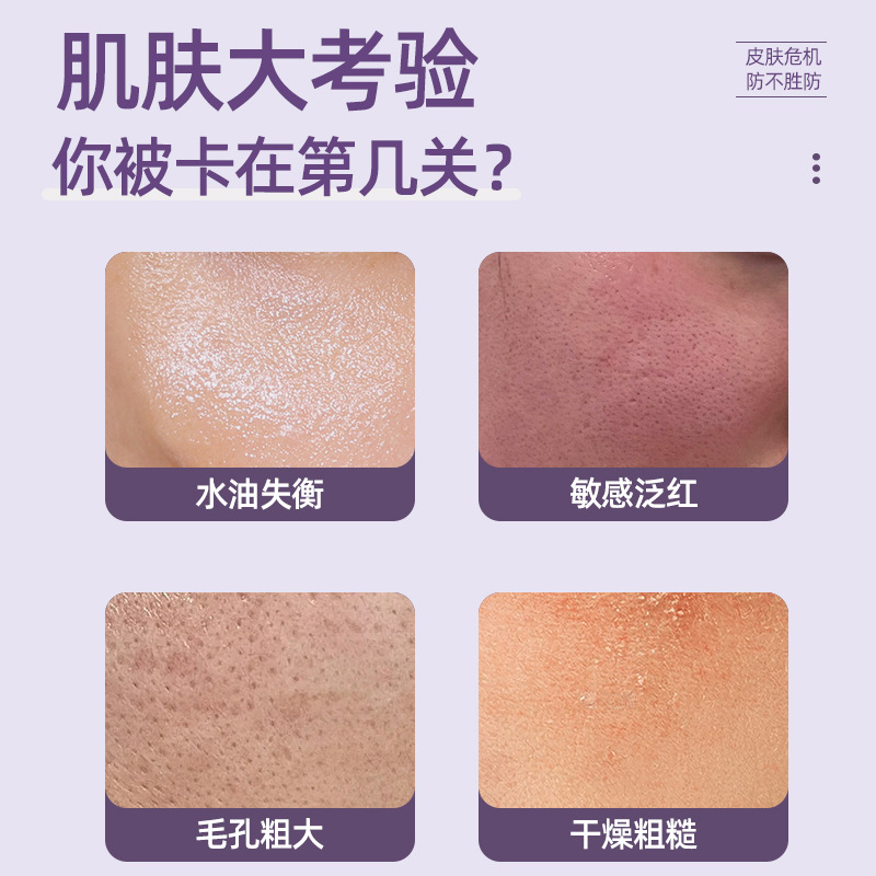 Su Xiu Chen's Azelaic Acid Cream 20% Improves Drying, Redness, Hydration, Smooth, Delicate and Gloss