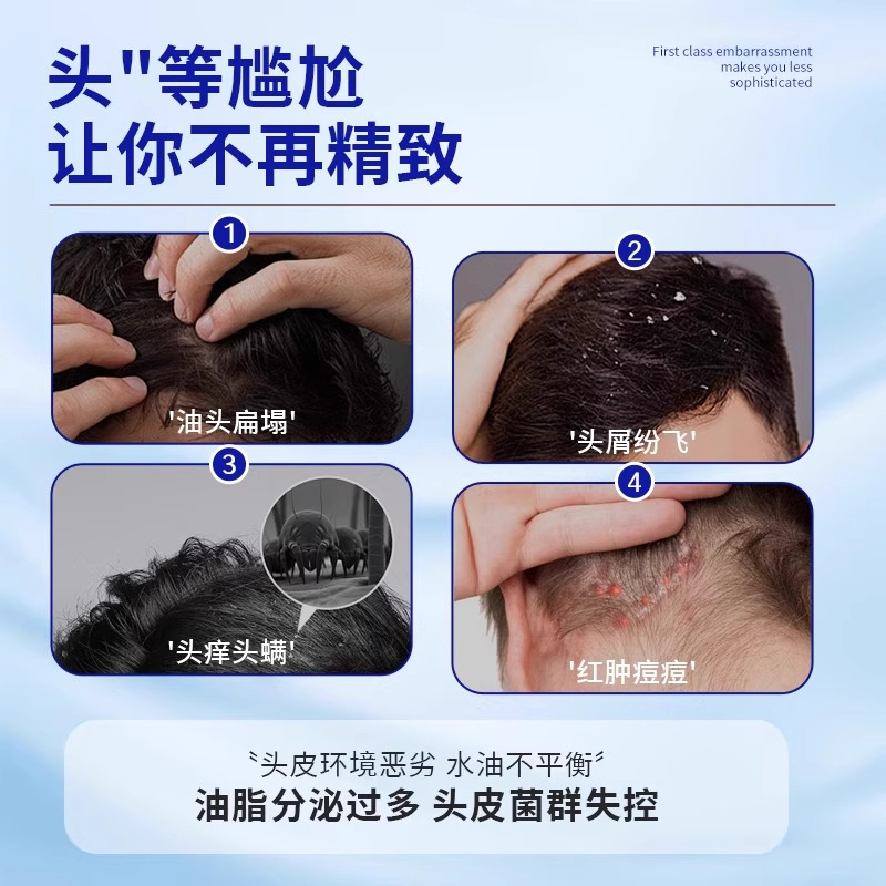 Zsea Ocean Supreme Oil Control Anti-Dandruff Shampoo Men's Special Fluffy Anti-Itch Long-Lasting Fragrance Shampoo Summer