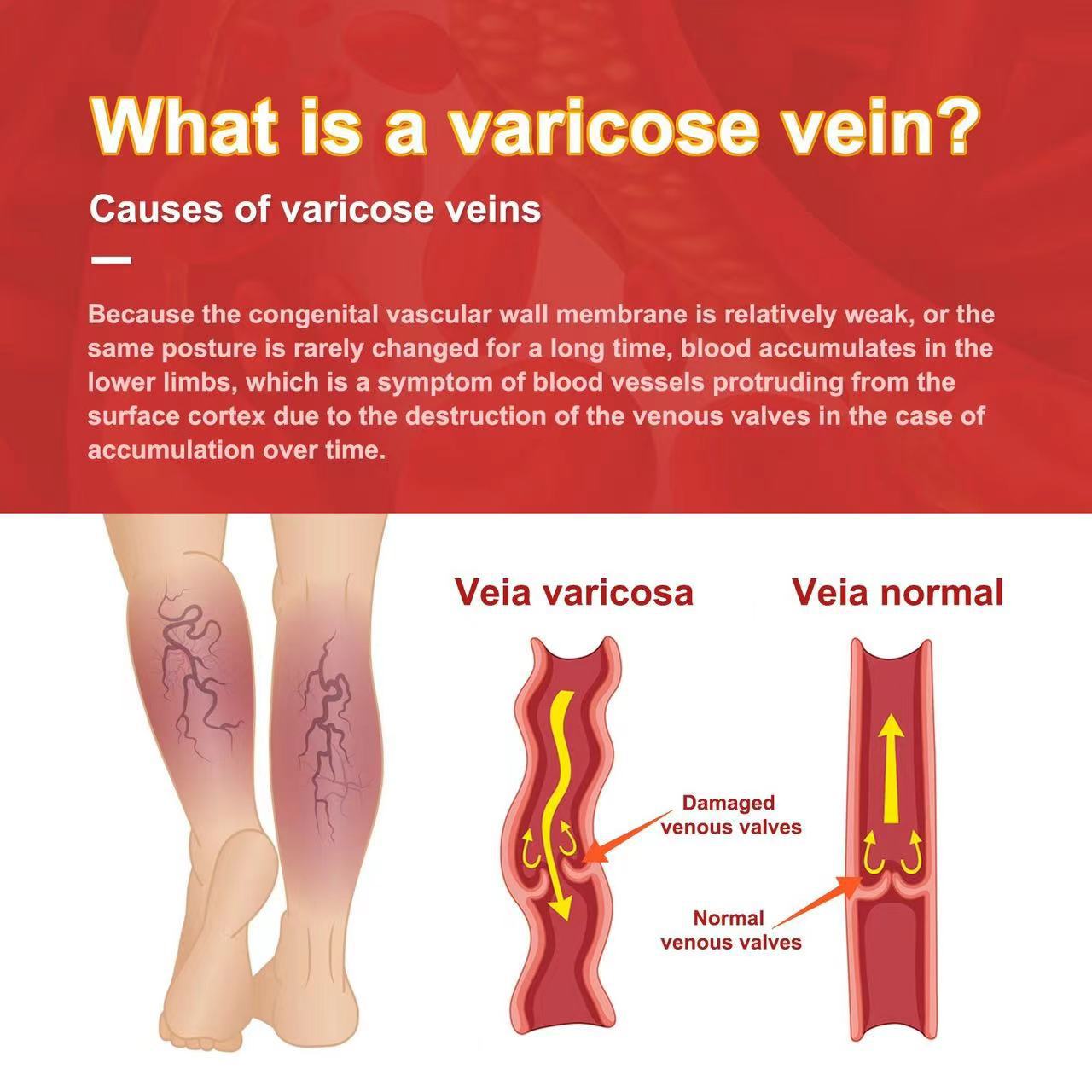 Cross-border foreign trade intravenous repair patch to relieve pain and swelling to prevent blood vessel blockage intravenous health patch factory