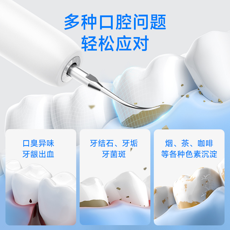 Yue'Er Curved Ultrasonic Tooth Cleaner Household Smart Ultrasonic Tooth Cleaner to Remove Tartar Personal Care Tooth Beauty Instrument