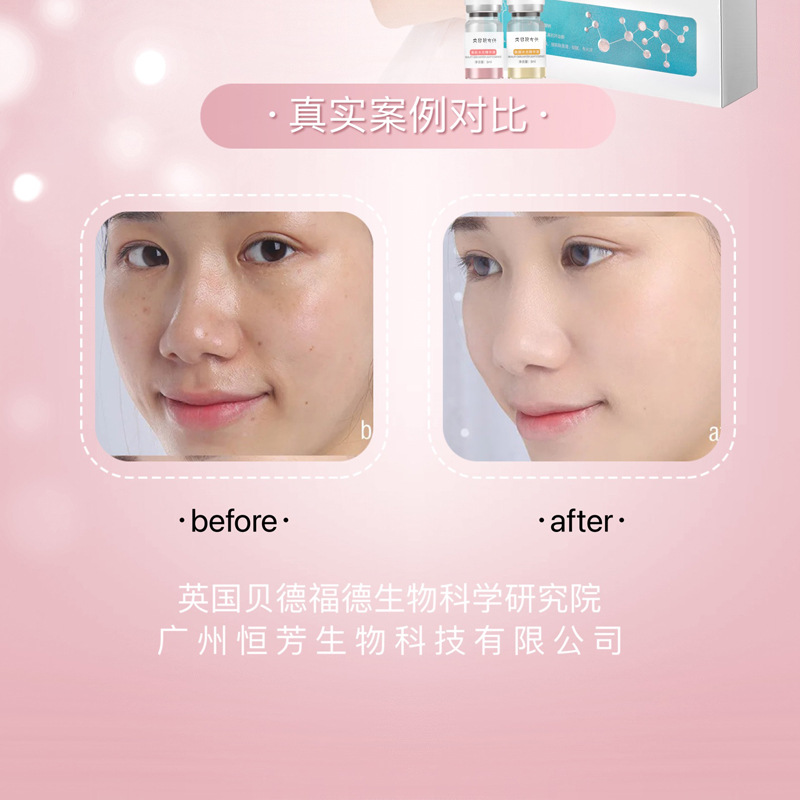 Beauty Salon Specializes in Skin Care Products, Water Light Kinetic Energy Element, Professional Line Efficacy Type Water Light Essence, Original Solution, Home Water Light