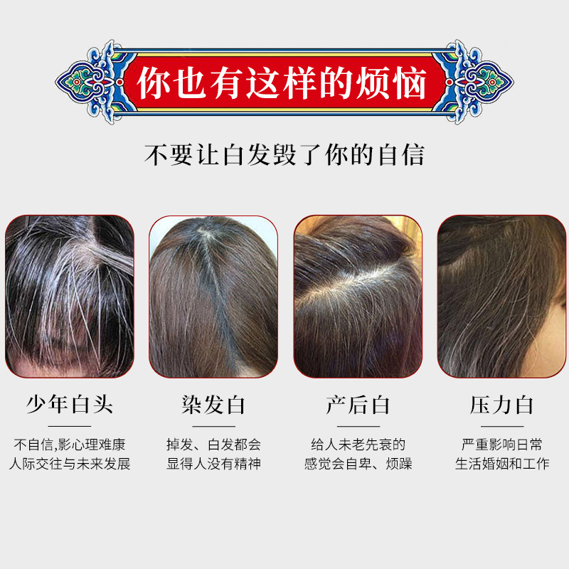 South China Institute of Biomedical Research white hair black hair Medical cold compress gel Polygonum multiflorum liquid scalp care white to black