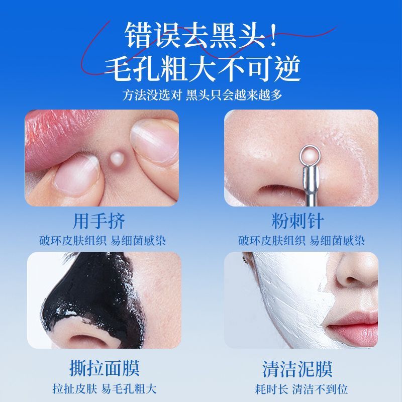 Konka Microbubble Blackhead Suction Instrument Beauty Instrument Facial Pore Cleaning Blackhead and Acne Removal Artifact Household Suction Device