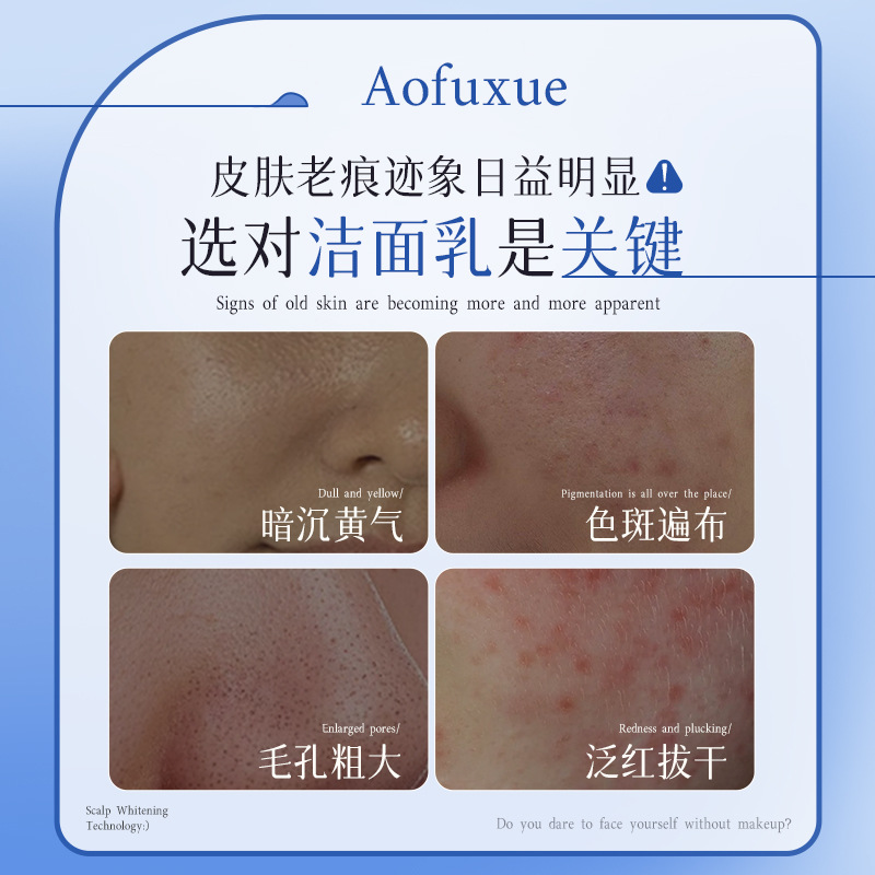 Aufuxue 377 Whitening and Lightening Facial Cleanser, Oil Control, Freckle Removal, Yellowing, Darkening and Whitening Facial Cleanser, Large Capacity 300ml