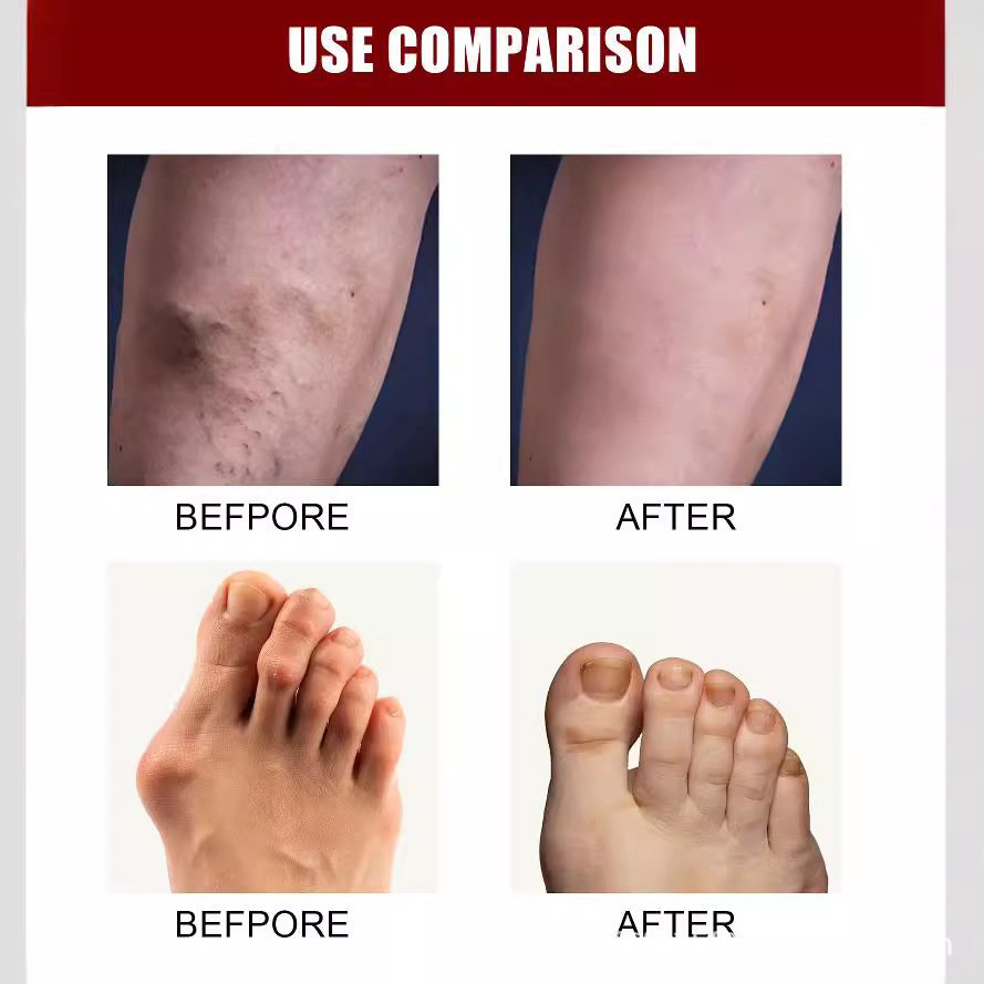 Joint Bone Collagen Cream Soothes Joint Bone Pain, Deformation Correction and Repair 50g Box