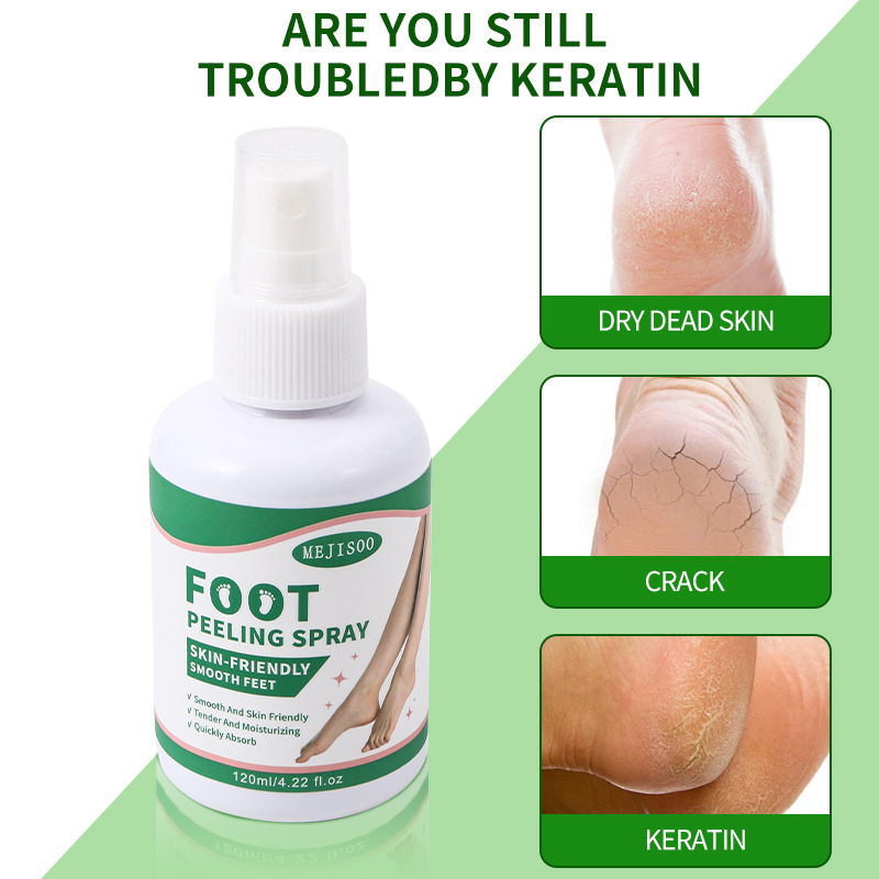 Foreign Trade Cross-border Foot Peeling Spray Foot Exfoliating Spray Hydrating Moisturizing Foot Care