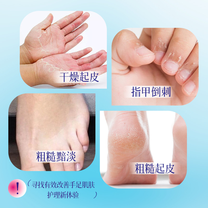 Vaseline Niacinamide Hand and Foot Film White Hydrating Moisturizing Anti-cracking Exfoliating Hand and Foot Film Foot Film