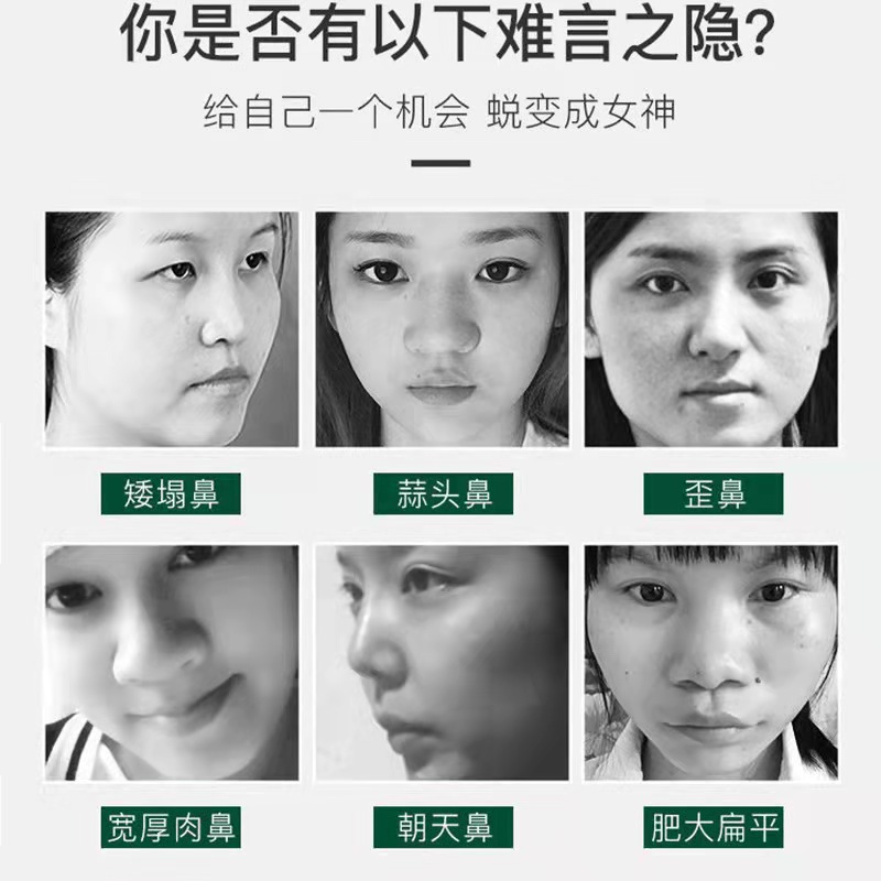 Beauty nose essential oil increases nose bridge stock solution reduces nose wing nose essence firm nose beauty nose artifact factory wholesale