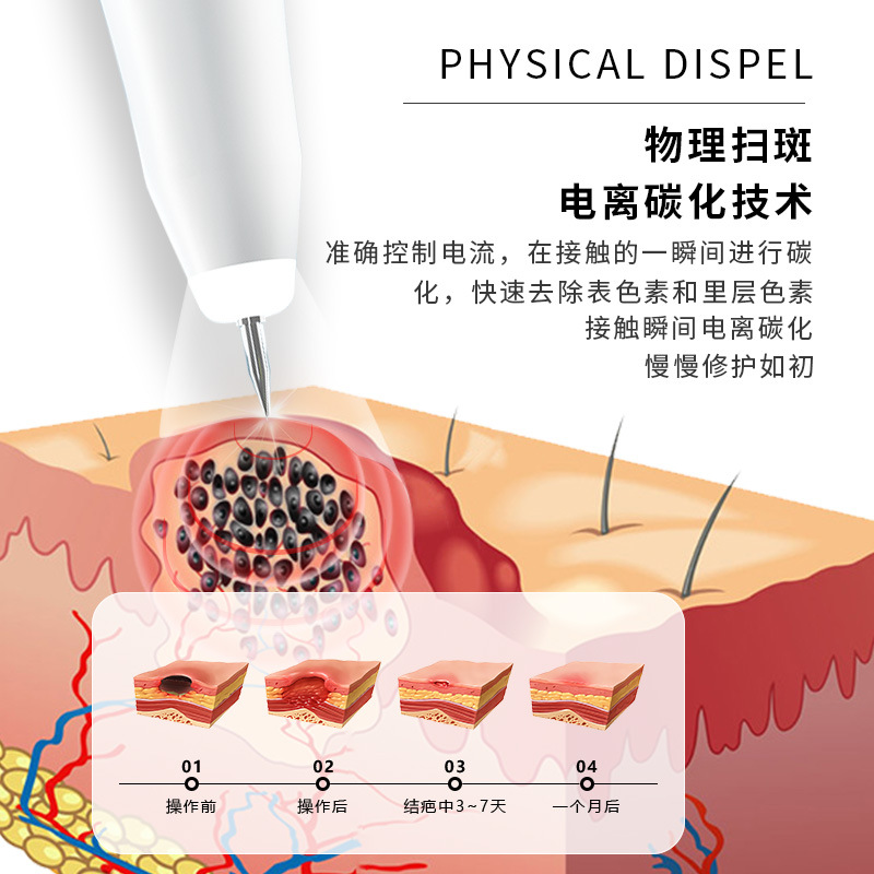 New handheld portable mole removal pen freckle removal pen for Bud meat beauty special tattoo removal acne marks mole removal pen