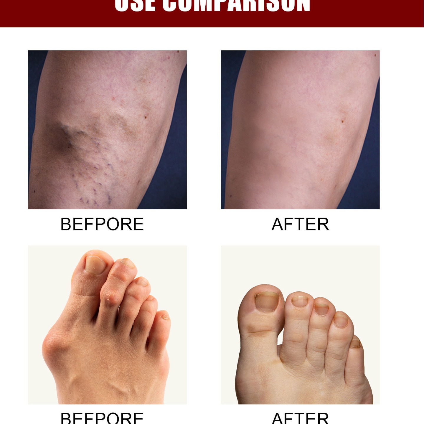 Joint bone collagen cream to relieve joint bone pain deformation correction repair boxed factory direct sales