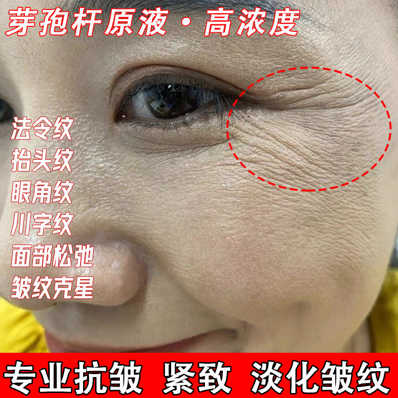 Антивозрастная эссенция, укрепляющая, подтягивающая и уменьшающая мелкие морщины, удаляющая носогубные складки, высокая концентрация споровой эссенции