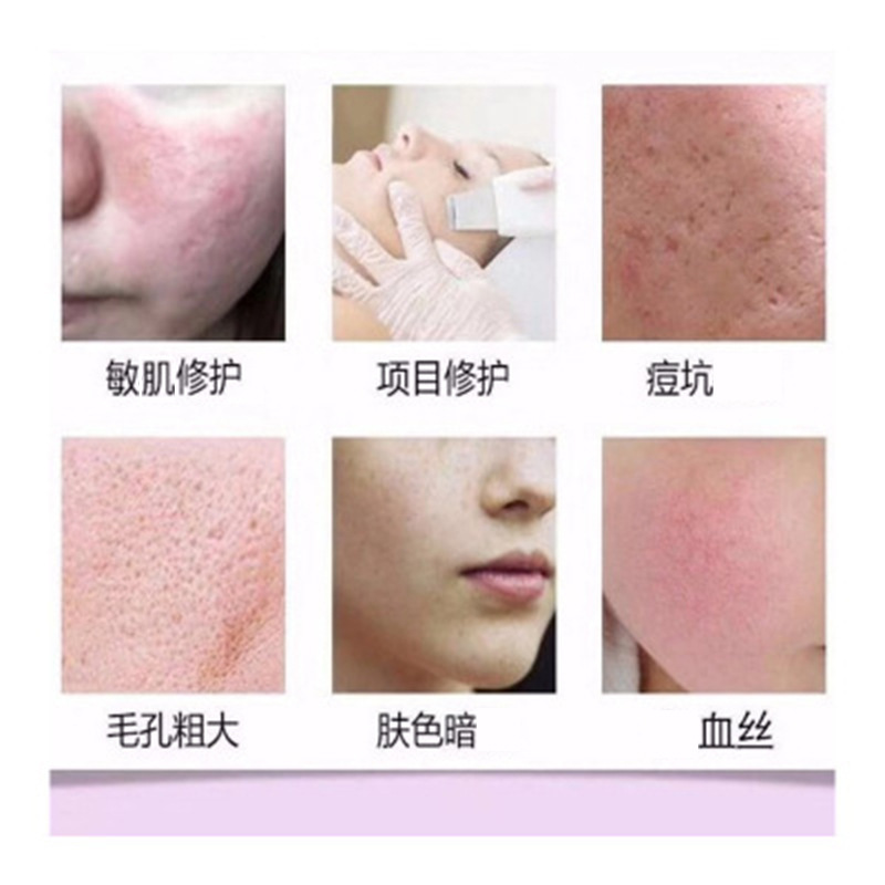 Freeze-dried powder repair activity beauty salon line for oligopeptide blue copper peptide peptide repair collagen freeze-dried powder