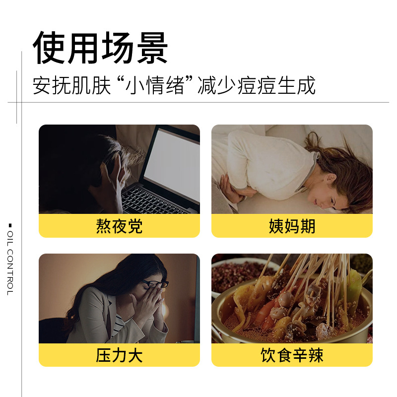 Han Lun Meiyu Oil Control Anti-acne Essence Desalinization of Acne Seal Repair of Acne Scar Large Bulb Convergence to Close Essence