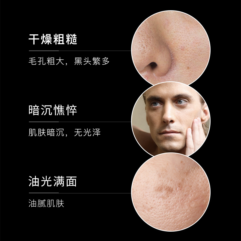 Fanzhen men's facial cleanser oil control three-piece set refreshing mild facial cleanser men's special skin care set Wholesale