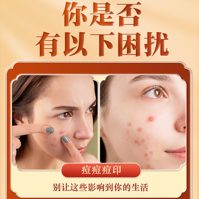 Yunnan Herbal Licorice Flavonoid Cream Spot Fading Melanin Acne Mark Ointment Source Manufacturer Dropshipping