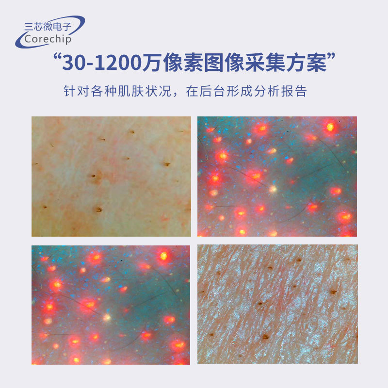 Skin Detector for Acne, Black Spots and Pores, 13 Major Problems, Three Spectrum Analysis