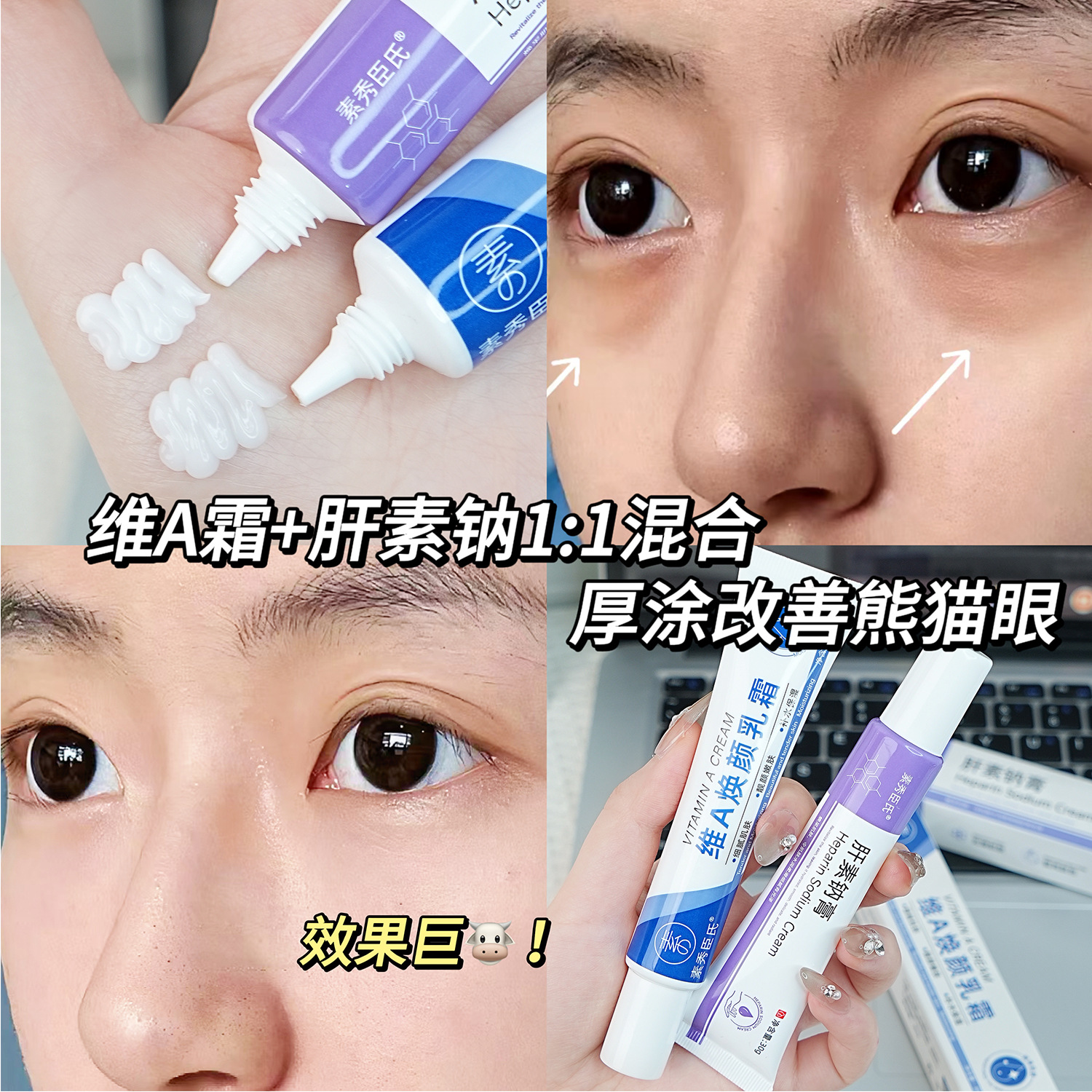 Su Xiu Chen's Heparin Sodium Ointment Vitamin A Rejuvenating Cream Improving Pimples Close the Mouth, Delicate Skin Rejuvenation and Moisturizing Ointment