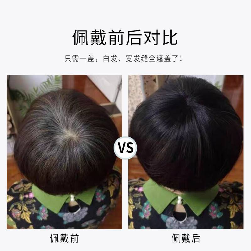 Real Hair Overhead Repair Women's Cover White Hair Covering Bald Head with Needle Breathable Real-life Hair Short Straight Hair Wig Women's