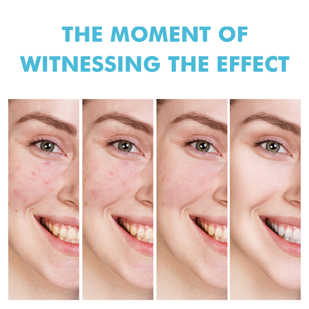 Cross-Border Salicylic Acid Anti-Acne Cream Fades Acne Marks, Removes Acne, Closes Mouth, Shrinks Pores, Plant Essence Anti-Acne Gel