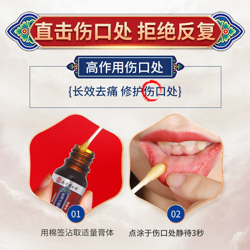 Nanjing Tongrentang Gel Oral Spray Fire Rotten Mouth Tongue Oral Aphthous Sores Fire Spray