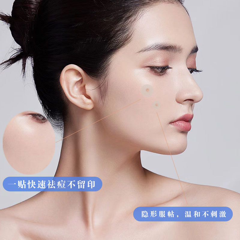 Hydrocolloid invisible acne patch factory wholesale artificial skin makeup suction concealer sterile dressing acne patch