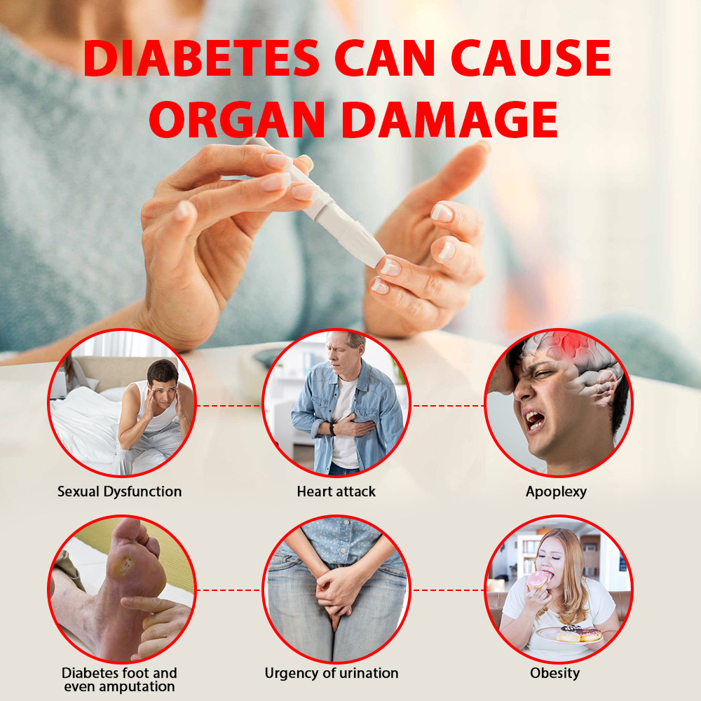 Sumifun Cross-Border Export Hypoglycemic Health Cream Diabetes Care Cream Regulates Blood Sugar Balance Health K10129