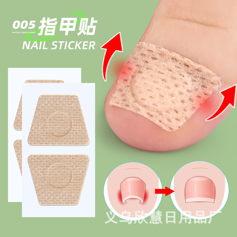 Disposable Breathable Nail Orthopedic Patch Inserting Nail Groove into Meat Long Toe Pad Soft Nail Achomycosis Care Patch