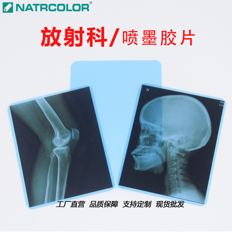 Рентгеновская пленка синего цвета, 8*10, медицинская пленка для сухой обработки