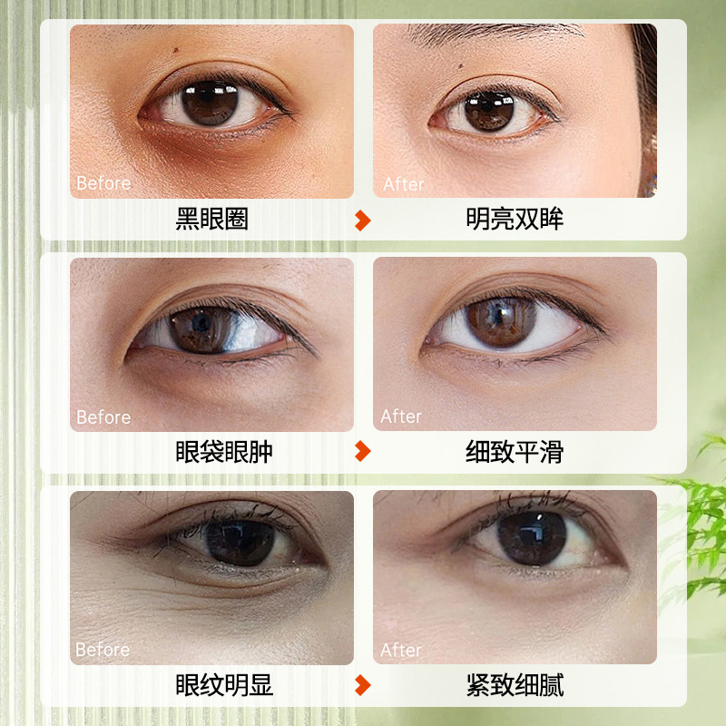 Han Runyi Firming and Lightening Gold Eye Mask Collagen Hydrating Eye Mask Moisturizing and Diminishing Dark Circles Eye Mask