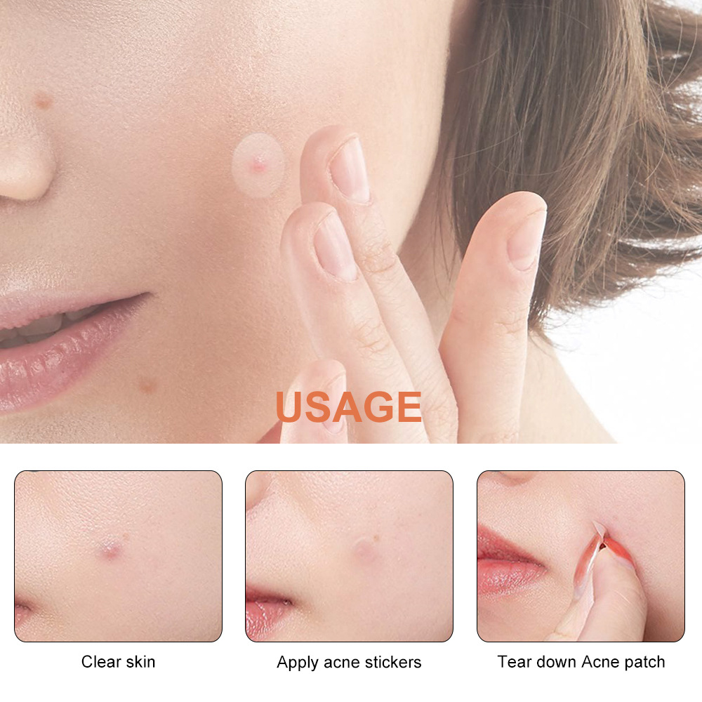 Invisible Transparent Particle Acne Patch Pe Self-Adhesive Covering Skin Invisible Tattoo Makeup Concealer Patch